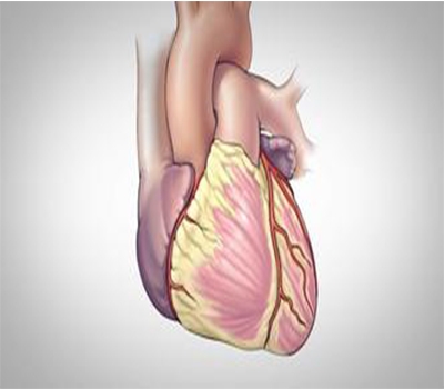 Coronary Surgery - Dr. Pravin Kulkarni